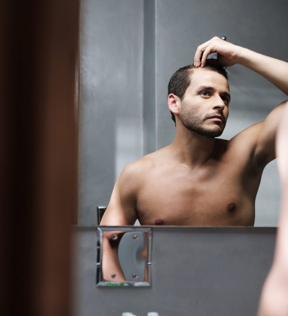 A worried young white man looks at himself in the mirror and inspects his premature receding hairline. Attractive Caucasian male adult in his 20s concerned about losing hair. Male pattern baldness